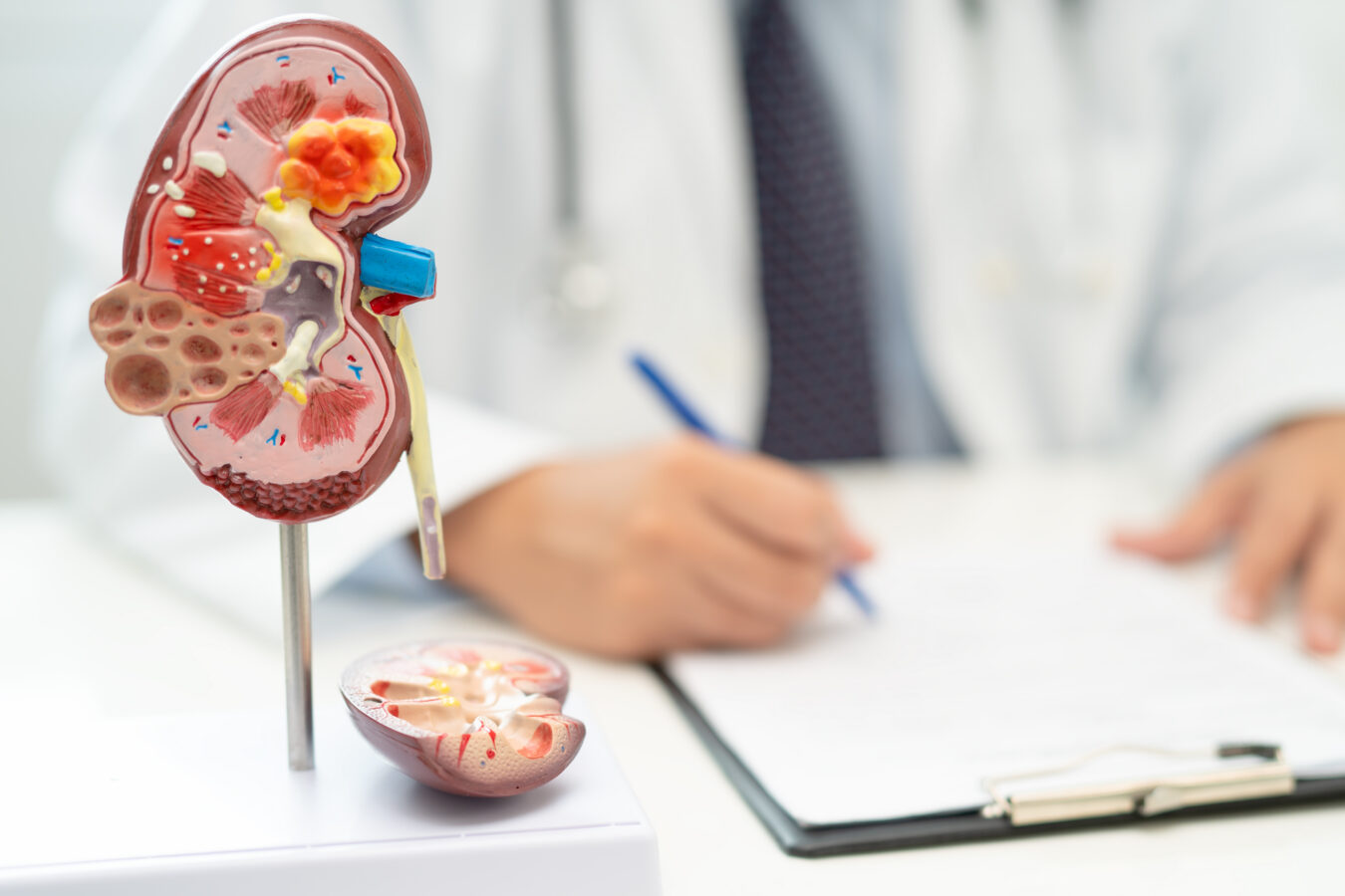 Kidney disease, Chronic kidney disease ckd, Doctor with human mo